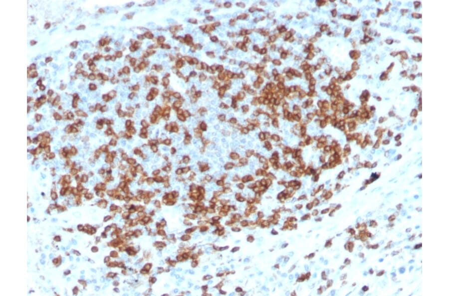 Immunohistochemistry - Anti-CD3 epsilon Antibody [C3e/3125R] - BSA and Azide free (A253686) - Antibodies.com