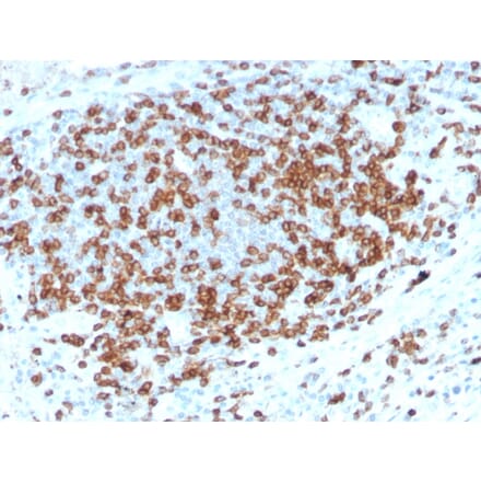 Immunohistochemistry - Anti-CD3 epsilon Antibody [C3e/3125R] - BSA and Azide free (A253686) - Antibodies.com