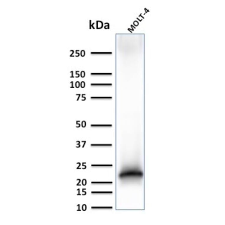 Western Blot - Anti-CD3 epsilon Antibody [C3e/3125R] - BSA and Azide free (A253687) - Antibodies.com