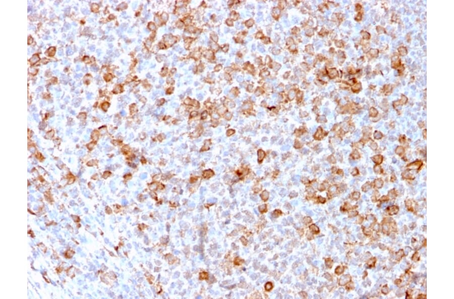 Immunohistochemistry - Anti-CD3 epsilon Antibody [C3e/3171R] - BSA and Azide free (A253687) - Antibodies.com