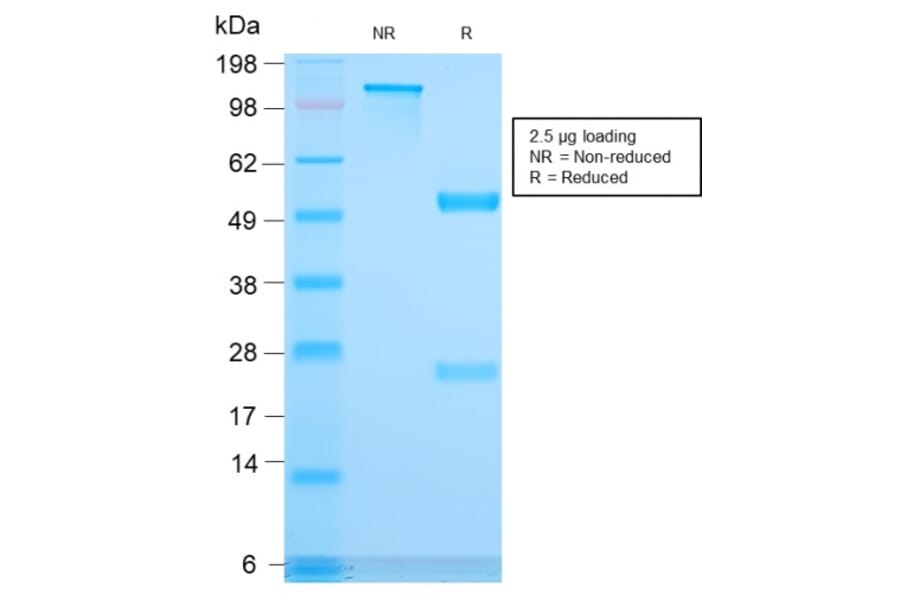 SDS-PAGE - Anti-CD3 epsilon Antibody [C3e/3171R] - BSA and Azide free (A253688) - Antibodies.com