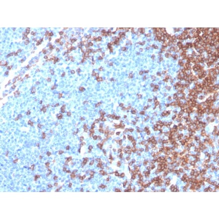 Immunohistochemistry - Anti-CD4 Antibody [rCD4/3930] - BSA and Azide free (A253692) - Antibodies.com