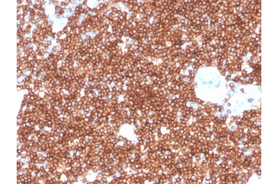 Immunohistochemistry - Anti-CD4 Antibody [rCD4/3930] - BSA and Azide free (A253692) - Antibodies.com