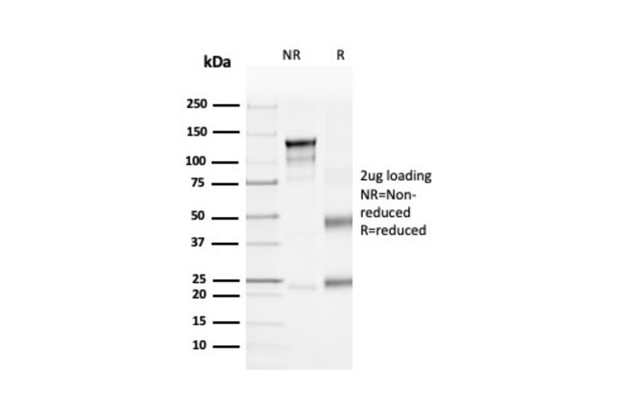SDS-PAGE - Anti-CD4 Antibody [rCD4/3930] - BSA and Azide free (A253692) - Antibodies.com