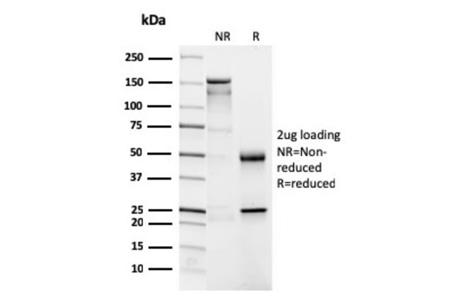 SDS-PAGE - Anti-CD4 Antibody [CD4/3026] - BSA and Azide free (A253697) - Antibodies.com