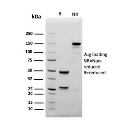 SDS-PAGE - Anti-CD4 Antibody [rC4/206] - BSA and Azide free (A253699) - Antibodies.com