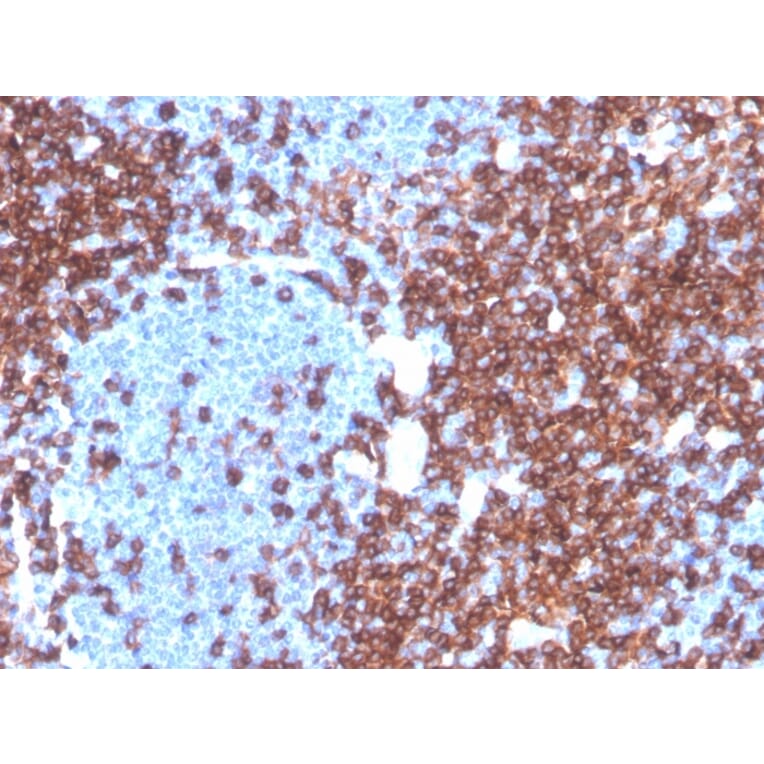 Immunohistochemistry - Anti-CD4 Antibody [CD4/3619R] - BSA and Azide free (A253700) - Antibodies.com