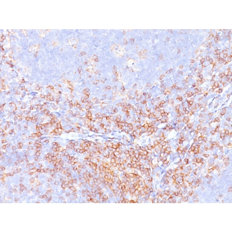 Immunohistochemistry - Anti-CD4 Antibody [CD4/3619R] - BSA and Azide free (A253700) - Antibodies.com