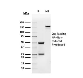 SDS-PAGE - Anti-BMP15 Antibody [BMP15/4263] - BSA and Azide free (A253700) - Antibodies.com