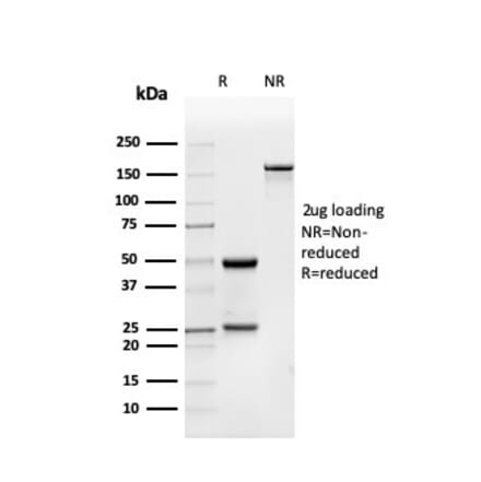 SDS-PAGE - Anti-BMP15 Antibody [BMP15/4263] - BSA and Azide free (A253700) - Antibodies.com