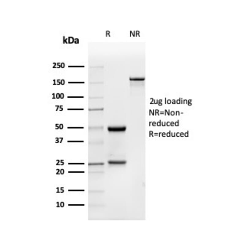 SDS-PAGE - Anti-BMP15 Antibody [BMP15/4263] - BSA and Azide free (A253700) - Antibodies.com