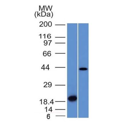 Western Blot - Anti-Aurora B Antibody [AURKB/1521] - BSA and Azide free (A253702) - Antibodies.com