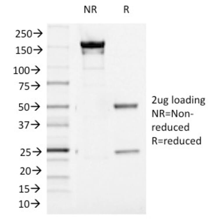 SDS-PAGE - Anti-Aurora B Antibody [AURKB/1521] - BSA and Azide free (A253701) - Antibodies.com