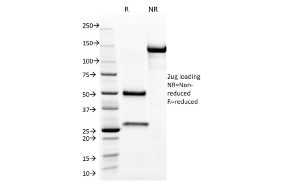 SDS-PAGE - Anti-Aurora B Antibody [AURKB/1593] - BSA and Azide free (A253704) - Antibodies.com