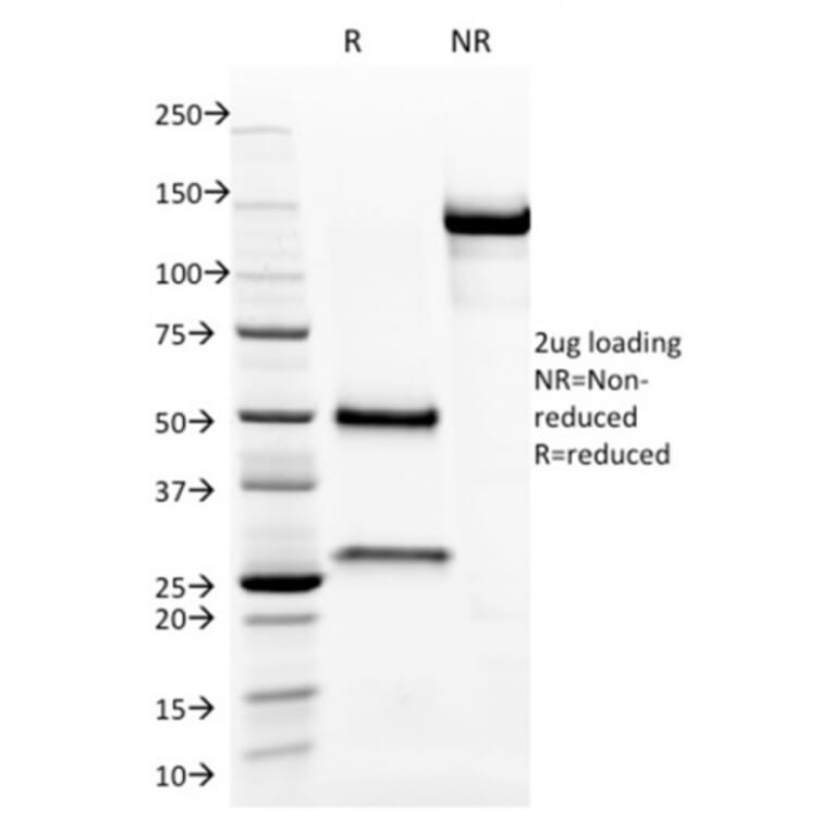 SDS-PAGE - Anti-Aurora B Antibody [AURKB/1593] - BSA and Azide free (A253704) - Antibodies.com
