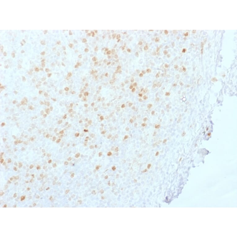 Immunohistochemistry - Anti-Aurora B Antibody [AURKB/1845] - BSA and Azide free (A253704) - Antibodies.com