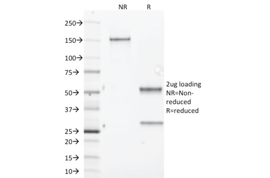 SDS-PAGE - Anti-Aurora B Antibody [AURKB/1845] - BSA and Azide free (A253705) - Antibodies.com