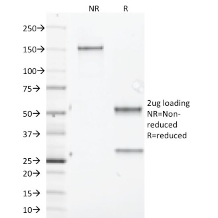 SDS-PAGE - Anti-Aurora B Antibody [AURKB/1845] - BSA and Azide free (A253705) - Antibodies.com