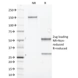 SDS-PAGE - Anti-Aurora B Antibody [AURKB/1845] - BSA and Azide free (A253705) - Antibodies.com