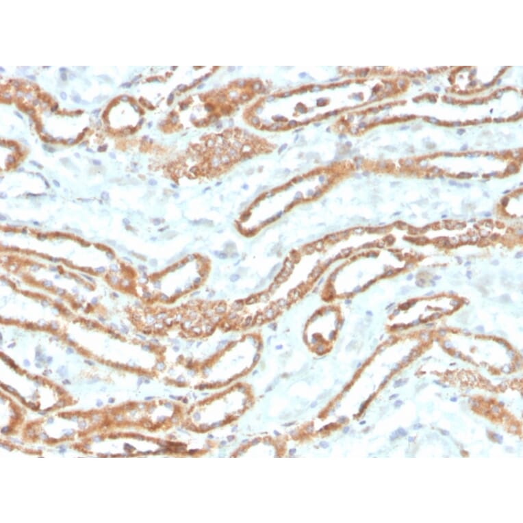 Immunohistochemistry - Anti-Aurora B Antibody [rAURKB/1592] - BSA and Azide free (A253706) - Antibodies.com