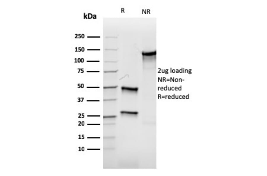 SDS-PAGE - Anti-Aurora B Antibody [rAURKB/1592] - BSA and Azide free (A253706) - Antibodies.com