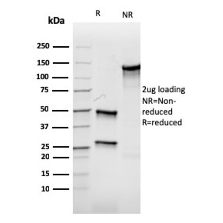 SDS-PAGE - Anti-Aurora B Antibody [rAURKB/1592] - BSA and Azide free (A253706) - Antibodies.com