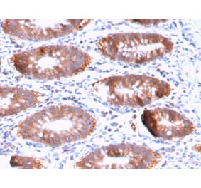 Immunohistochemistry - Anti-Aurora B Antibody [AURKB/3121R] - BSA and Azide free (A253706) - Antibodies.com