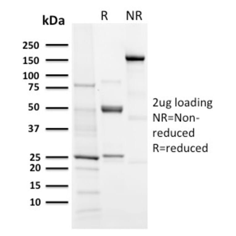 SDS-PAGE - Anti-Aurora B Antibody [AURKB/3121R] - BSA and Azide free (A253707) - Antibodies.com