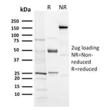 SDS-PAGE - Anti-Aurora B Antibody [AURKB/3121R] - BSA and Azide free (A253707) - Antibodies.com