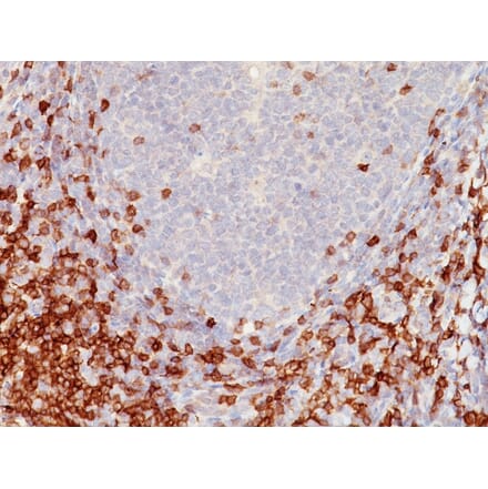 Immunohistochemistry - Anti-CD5 Antibody [C5/473] - BSA and Azide free (A253707) - Antibodies.com