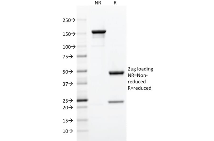 SDS-PAGE - Anti-CD5 Antibody [C5/473] - BSA and Azide free (A253708) - Antibodies.com