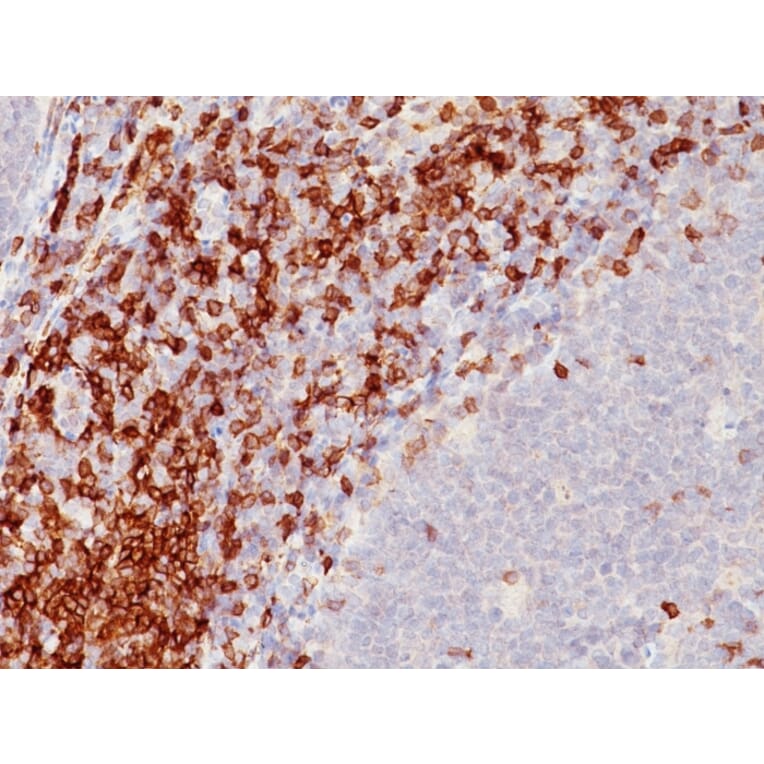 Immunohistochemistry - Anti-CD5 Antibody [SPM546] - BSA and Azide free (A253708) - Antibodies.com