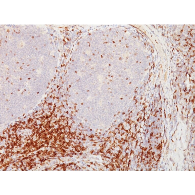 Immunohistochemistry - Anti-CD5 Antibody [CD5/54/F6] - BSA and Azide free (A253709) - Antibodies.com