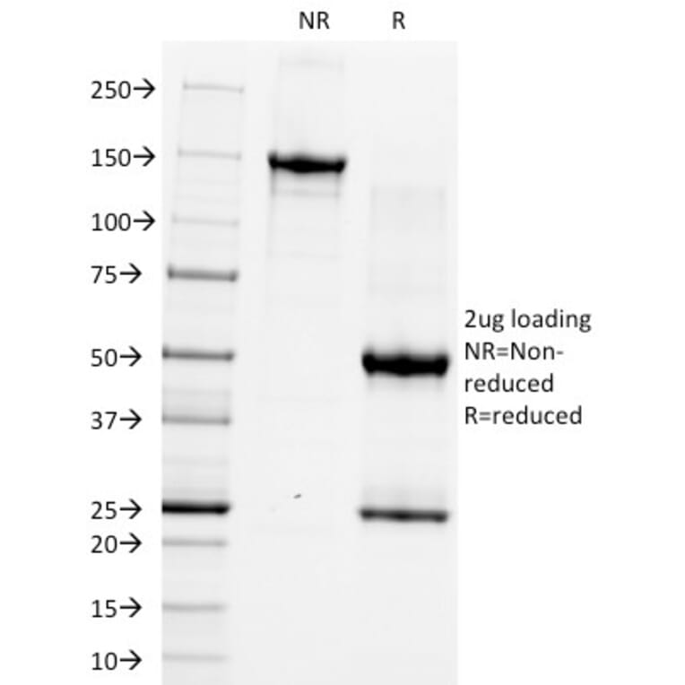 SDS-PAGE - Anti-CD5 Antibody [CRIS-1] - BSA and Azide free (A253712) - Antibodies.com