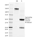 SDS-PAGE - Anti-CD5 Antibody [CRIS-1] - BSA and Azide free (A253712) - Antibodies.com