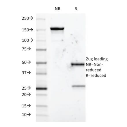 SDS-PAGE - Anti-CD5 Antibody [B-B8] - BSA and Azide free (A253712) - Antibodies.com