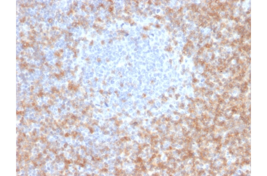 Immunohistochemistry - Anti-CD5 Antibody [CD5/2416] - BSA and Azide free (A253714) - Antibodies.com