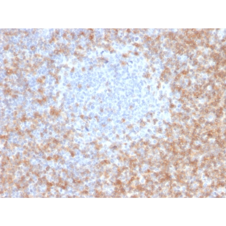 Immunohistochemistry - Anti-CD5 Antibody [CD5/2416] - BSA and Azide free (A253714) - Antibodies.com