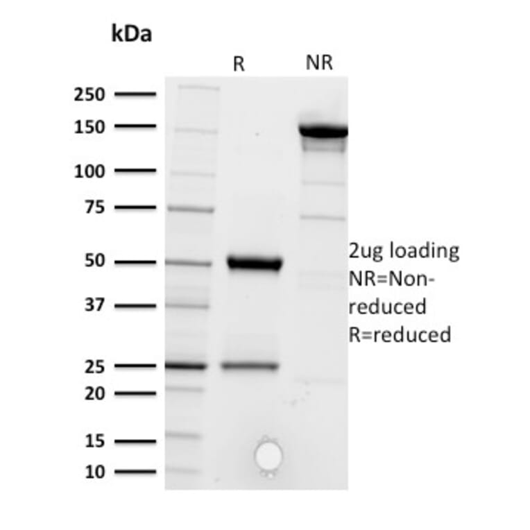 SDS-PAGE - Anti-CD5 Antibody [CD5/2416] - BSA and Azide free (A253714) - Antibodies.com