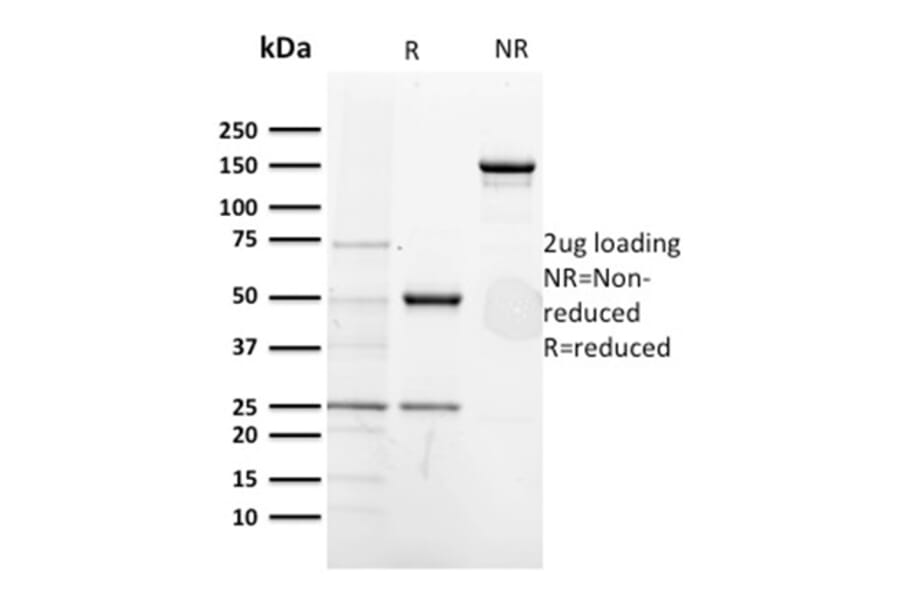 SDS-PAGE - Anti-CD5 Antibody [CD5/2418] - BSA and Azide free (A253715) - Antibodies.com