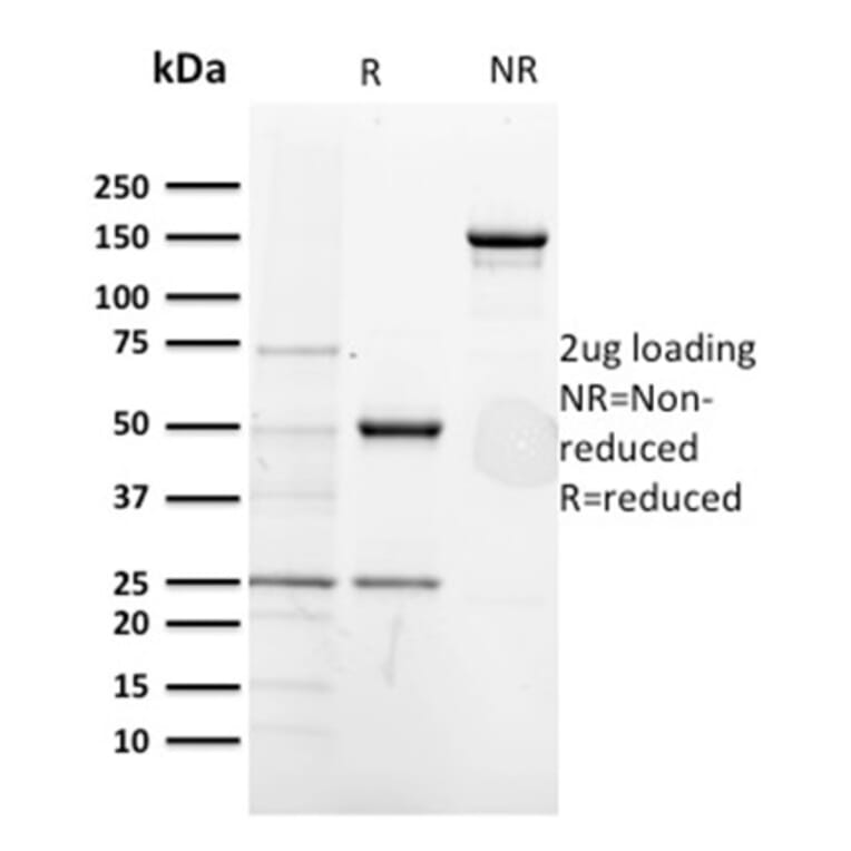 SDS-PAGE - Anti-CD5 Antibody [CD5/2418] - BSA and Azide free (A253715) - Antibodies.com