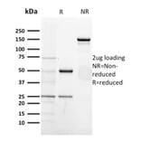 SDS-PAGE - Anti-CD5 Antibody [CD5/2418] - BSA and Azide free (A253715) - Antibodies.com