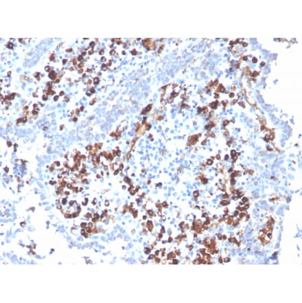 Immunohistochemistry - Anti-CD5L Antibody [CD5L/2991] - BSA and Azide free (A253717) - Antibodies.com