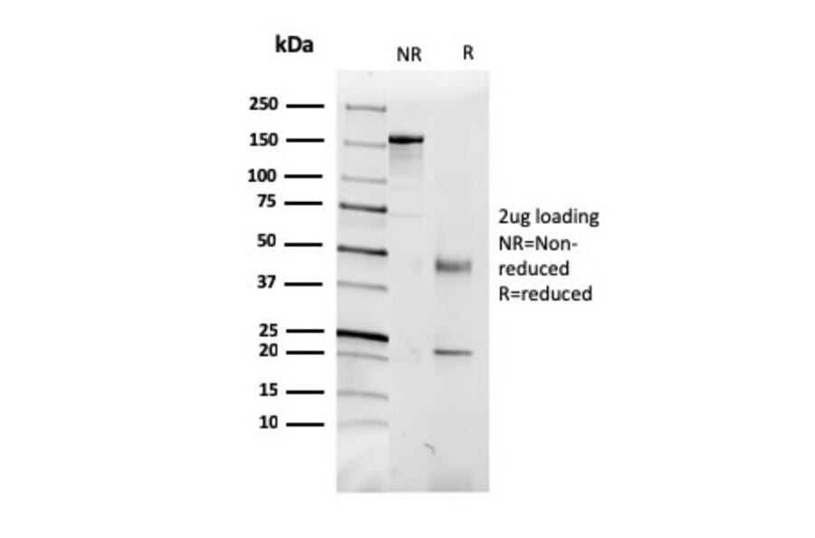 SDS-PAGE - Anti-CD5L Antibody [CD5L/2991] - BSA and Azide free (A253717) - Antibodies.com