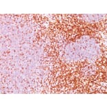 Immunohistochemistry - Anti-CD6 Antibody [3F7B5] - BSA and Azide free (A253718) - Antibodies.com
