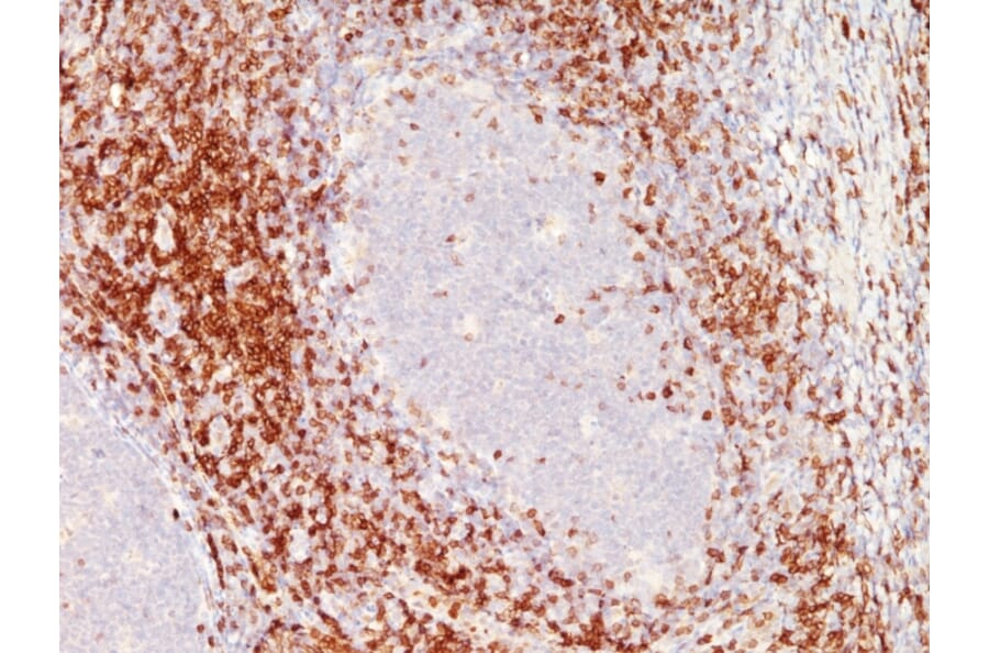 Immunohistochemistry - Anti-CD10 Antibody [C6/372+3F7B5] - BSA and Azide free (A253722) - Antibodies.com