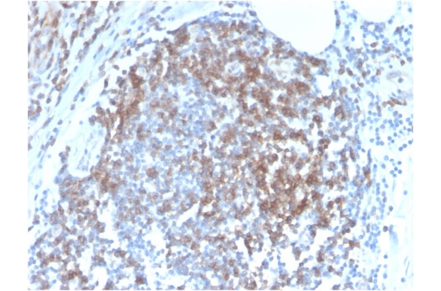 Immunohistochemistry - Anti-CD8 Antibody [C6/2884R] - BSA and Azide free (A253723) - Antibodies.com