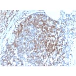 Immunohistochemistry - Anti-CD8 Antibody [C6/2884R] - BSA and Azide free (A253723) - Antibodies.com