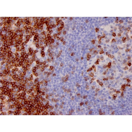 Immunohistochemistry - Anti-CD7 Antibody [CD7/3737] - BSA and Azide free (A253729) - Antibodies.com