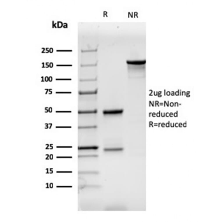 SDS-PAGE - Anti-CD7 Antibody [CD7/3737] - BSA and Azide free (A253729) - Antibodies.com